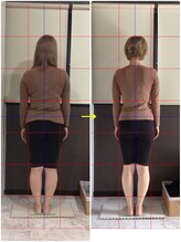 リラクゼーションアンドビューティー コウ(Kou)/【美容整骨/ダイエット編】