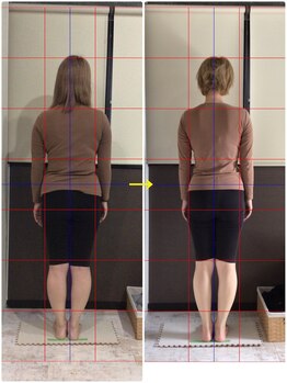 リラクゼーションアンドビューティー コウ(Kou)/【美容整骨/ダイエット編】