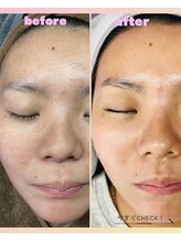 ナナラ(nanara)/マリムーブフェイシャルワックス