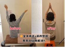 幸治鍼灸整骨院/上がらなかった手が上がりました