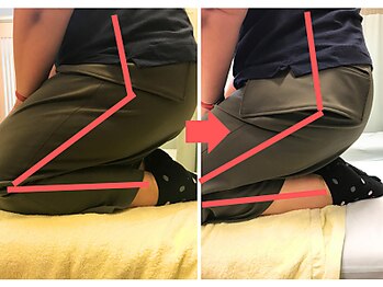 杉本接骨鍼灸院/膝の症状例:施術を受けた方の声