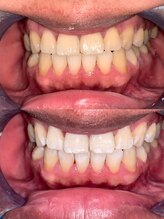 ライトビューティー 池袋店(LightBeauty)/症例写真