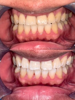 ライトビューティー 池袋店(LightBeauty)/症例写真