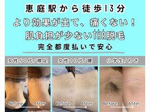 エースタイル(a-style)