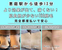 エースタイル(a-style)