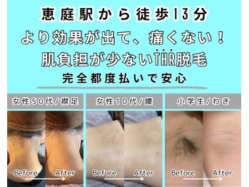 エースタイル(a-style)