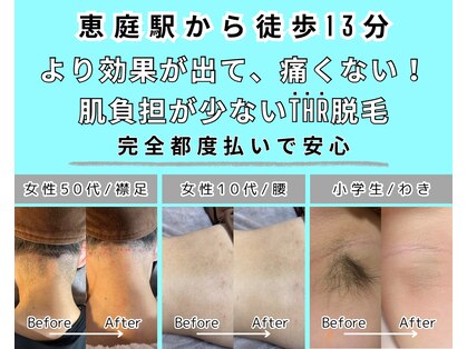 エースタイル(a-style)の写真