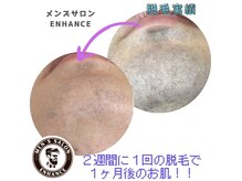 エンハンス 亀有(enhance)の雰囲気（1照射から脱毛実感できる！※個人差があります。）