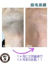 エンハンス 亀有(enhance)/脱毛実績