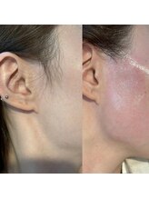 バイカラー(BY COLOR)/もみあげwax