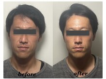 ブプラ 相模大野店(BUPURA)/もたつき解消♪トーンアップ