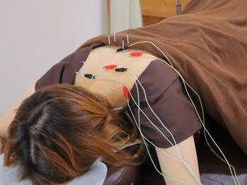 こと鍼灸院・整骨院/電流の強さも相談可能◎