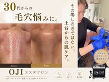オウジエステサロン(OJIエステサロン)