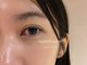 イオレ(IOLE)の写真