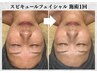 【毛穴悩み改善】速攻ハリツヤ肌!スピキュールフェイシャル60分¥20,000→