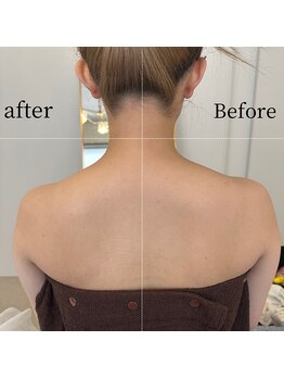 スリビア(SLIVIA)/人気！肩凝りビフォーアフター