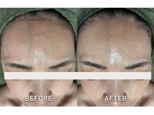 サロンドジェシカ(salon de Jessica)/フォト美顔　コラーゲンアップ