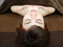 ブルースターの雰囲気（リフトアップと顔の左右バランス調整が得意なサロンです♪）
