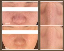 エノアビューティー(ENOA beauty)