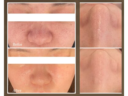 エノアビューティー(ENOA beauty)の写真