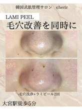 シェリール 大宮(cherir)/