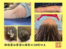 はりきゅう和 ルート鍼灸院