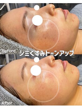 ラティーナ(Lattina)/陶肌ピール