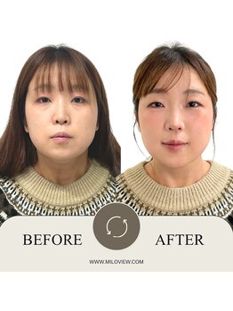 ミラビュー(MILOVIEW)/自分に似合うメイクをプロが提案