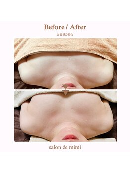 サロン ド ミミ(salon de mimi)/バストアップBeforeAfter