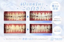 ブライトスマイル 静岡店(Bright Smile)