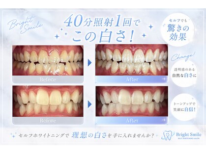 ブライトスマイル 静岡店(Bright Smile)の写真