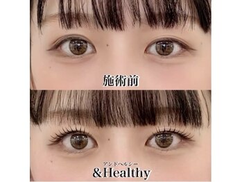 ドレス(DRESS.)の写真/持続力も仕上がりも妥協しない!話題のアンドヘルシーLEDマツエク×マツパで理想のぱっちり目元へ