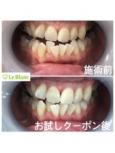 ルブラン 奈良店(Le Blanc)/ご紹介でご来店下さいました！