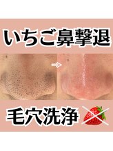 ラシュシュ(La chou chou)/毛穴洗浄/開き毛穴/ハリツヤ