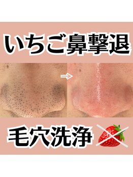 ラシュシュ(La chou chou)/毛穴洗浄/開き毛穴/ハリツヤ