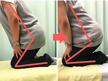 杉本接骨鍼灸院/膝の症状例:施術を受けた方の声