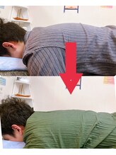 小顔22 ボルティ 赤坂支店(Bolty)/【悩み】猫背