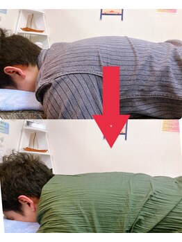 小顔22 ボルティ 赤坂支店(Bolty)/【悩み】猫背