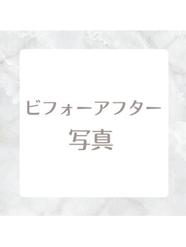ブランコ バイ ボンド(BLANCO By BOND)/