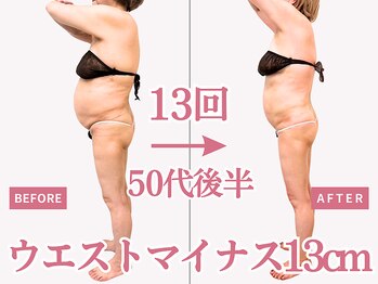 べモーレ 上本町 谷町九丁目(Bemolle)/50代痩身13回ビフォーアフター☆