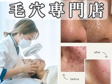 エスキン(ESSKIN)
