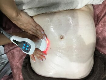 シン(sin)の写真/《引き締め痩身》男性の為の最新マシンでお腹をスッキリ!【辛い運動なし・徹底管理の痩身体験¥3980】