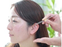 ジュピテールの雰囲気（1回20分で終わる♪針不使用、目立たない！【ダイエット・痩身】）