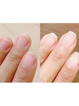 爪の悩みを解消できる（ケア含む）