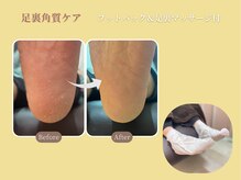 ココル 大塚駅前店(Cocol)/足裏角質ケアメニュー