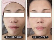 サロンリアン(salon Lien)/◇光フェイシャル◇