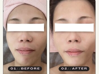 サロンリアン(salon Lien)/◇光フェイシャル◇