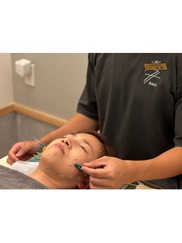 鍼灸施術を受けたい