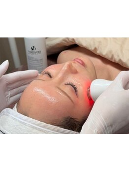 小顔になりたい