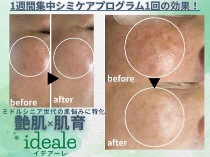 イデアーレ(ideale)の写真